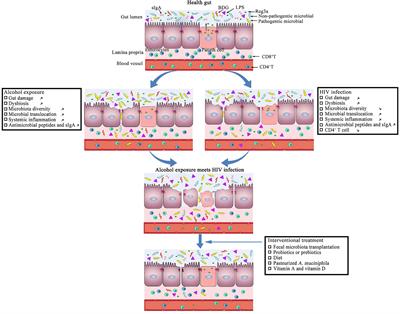 Alcohol Use and Abuse Conspires With HIV Infection to Aggravate Intestinal Dysbiosis and Increase Microbial Translocation in People Living With HIV: A Review